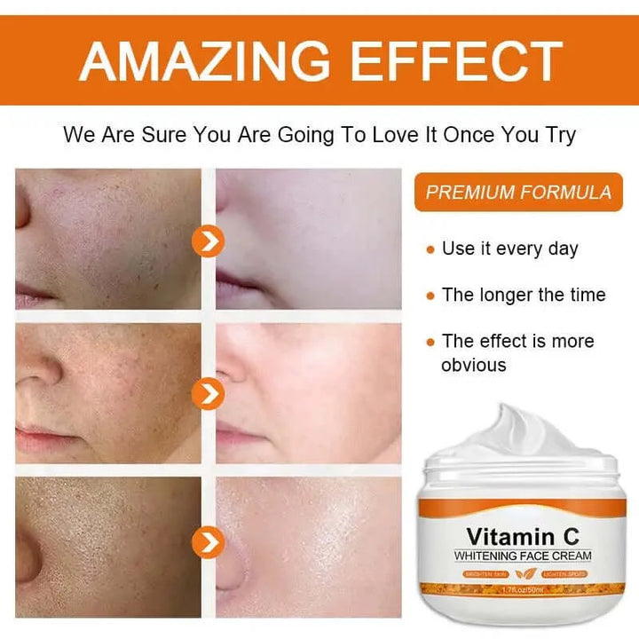 Vitamin C Face Cream Remove Dark Spots Whitening Care Moisturizing Anti-Aging Anti Wrinkle Firming Skin Care